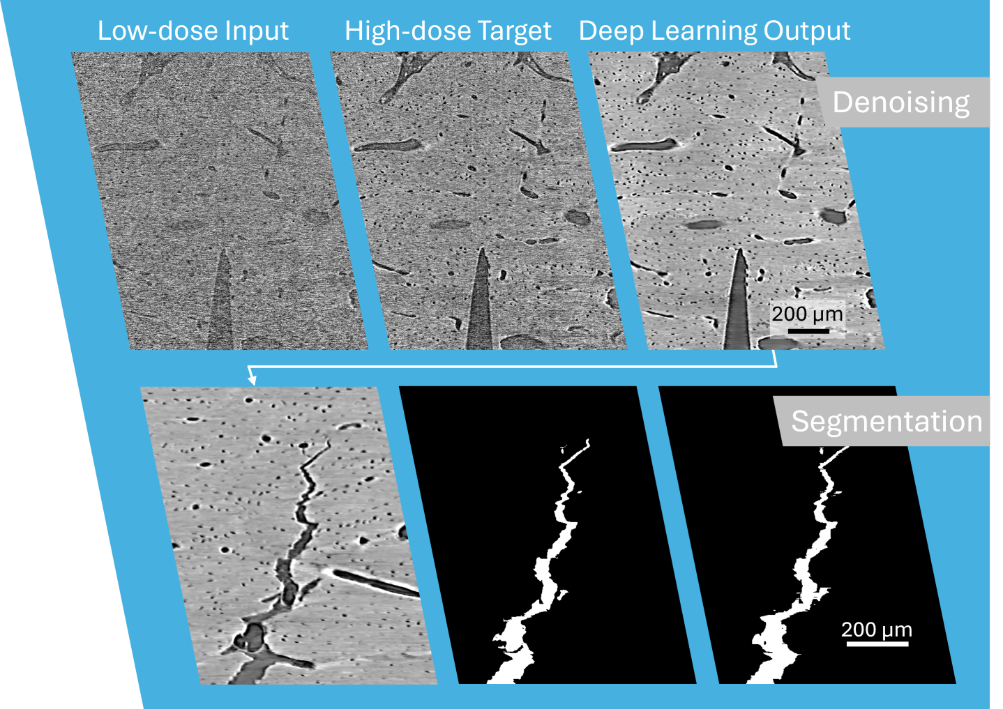 Deep learning for radiation dose reduction