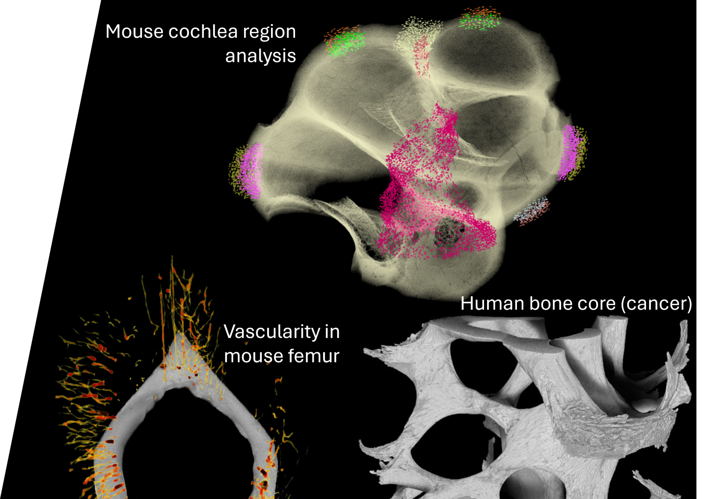 Data analysis of bone microstructure