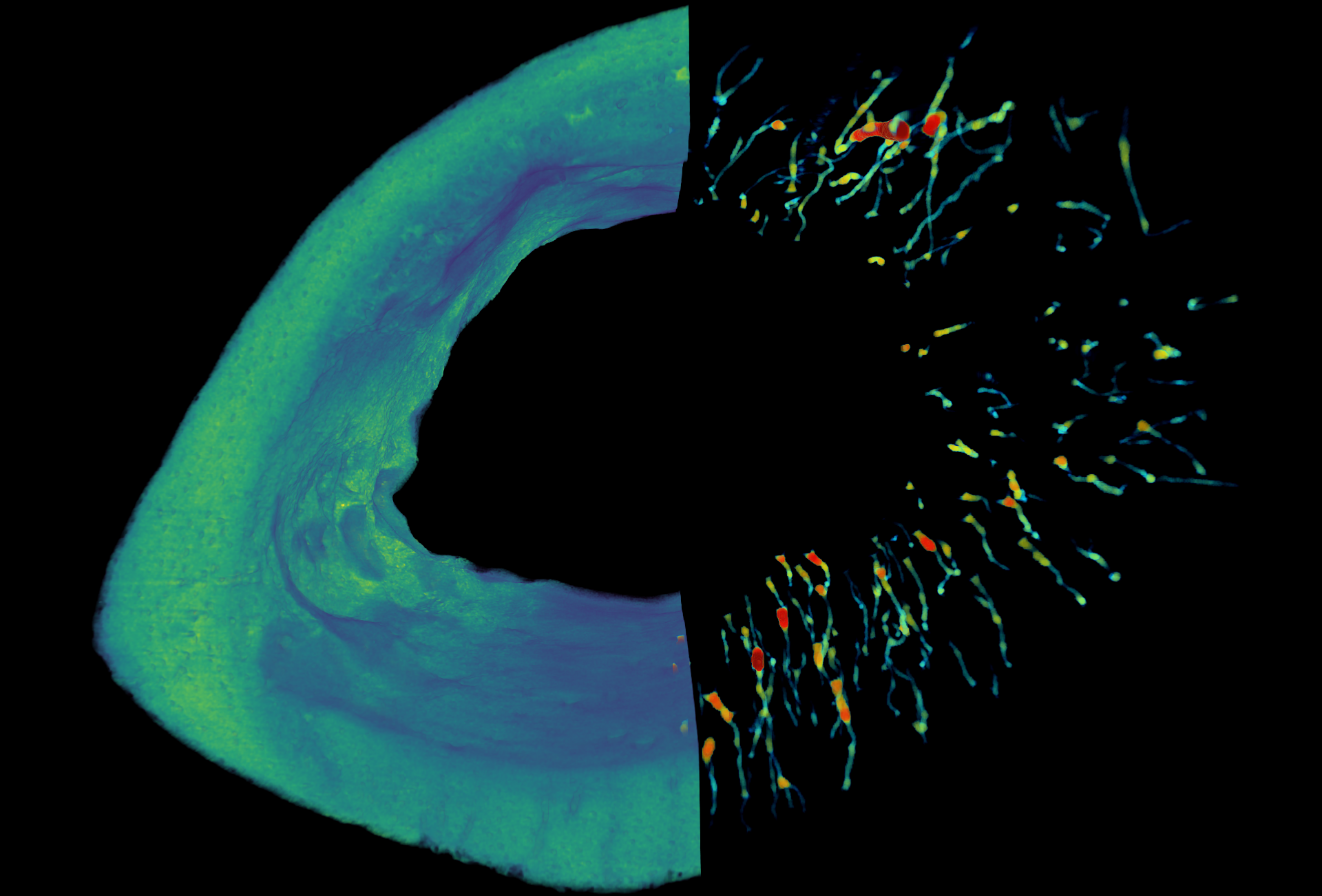 Quantitative Bone Imaging using Synchrotron Micro-computed Tomography